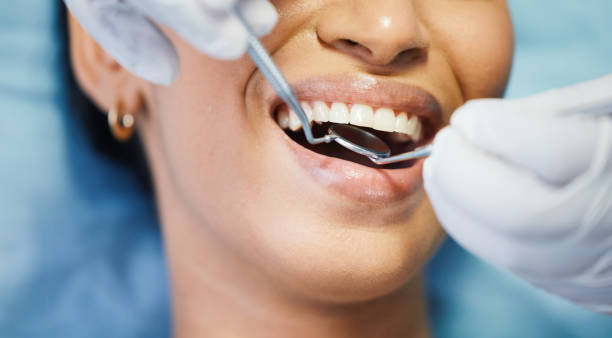 Best Urgent Care for Lost Fillings or Crowns in Fletcher, NC